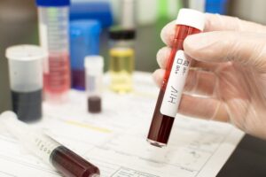 HIV/AIDS and drugs, HIV and Substance use disorders,